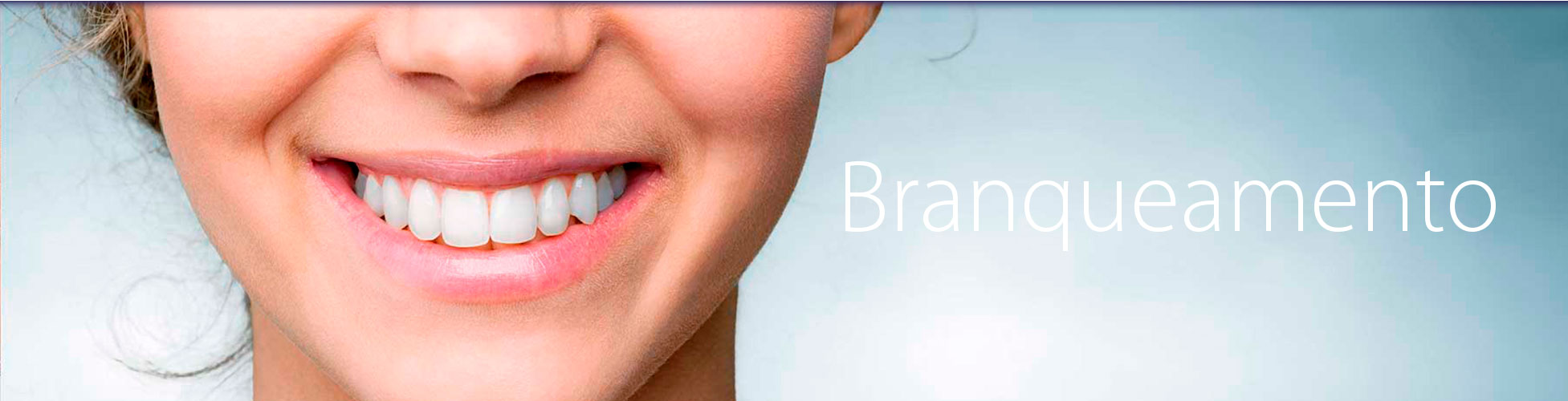 Clinica Medicina Dentaria - Antonio Cardoso - Branqueamento