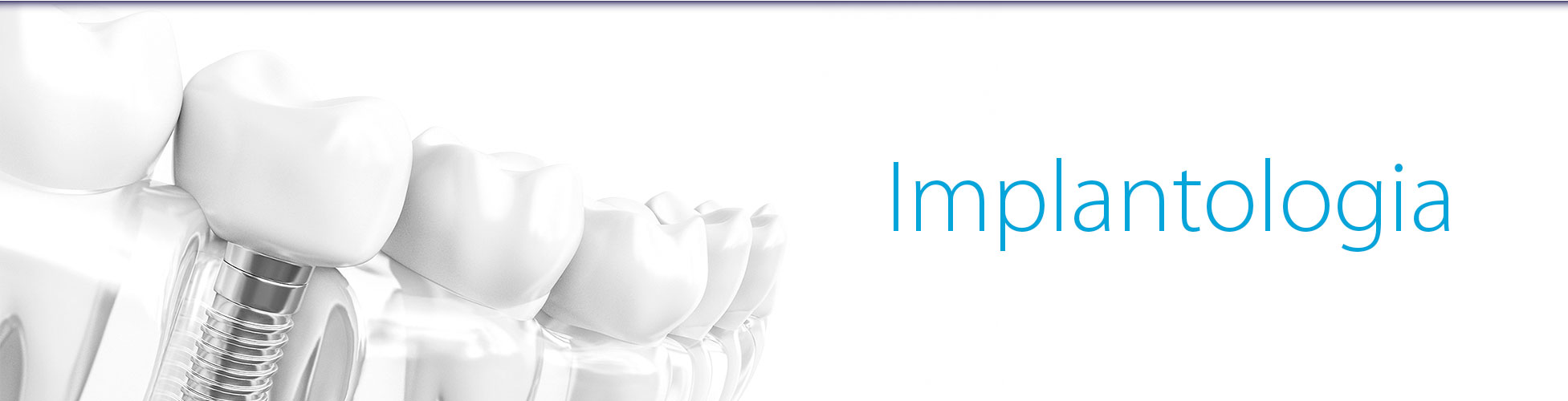 Clinica Medicina Dentaria - Antonio Cardoso - Implantologia