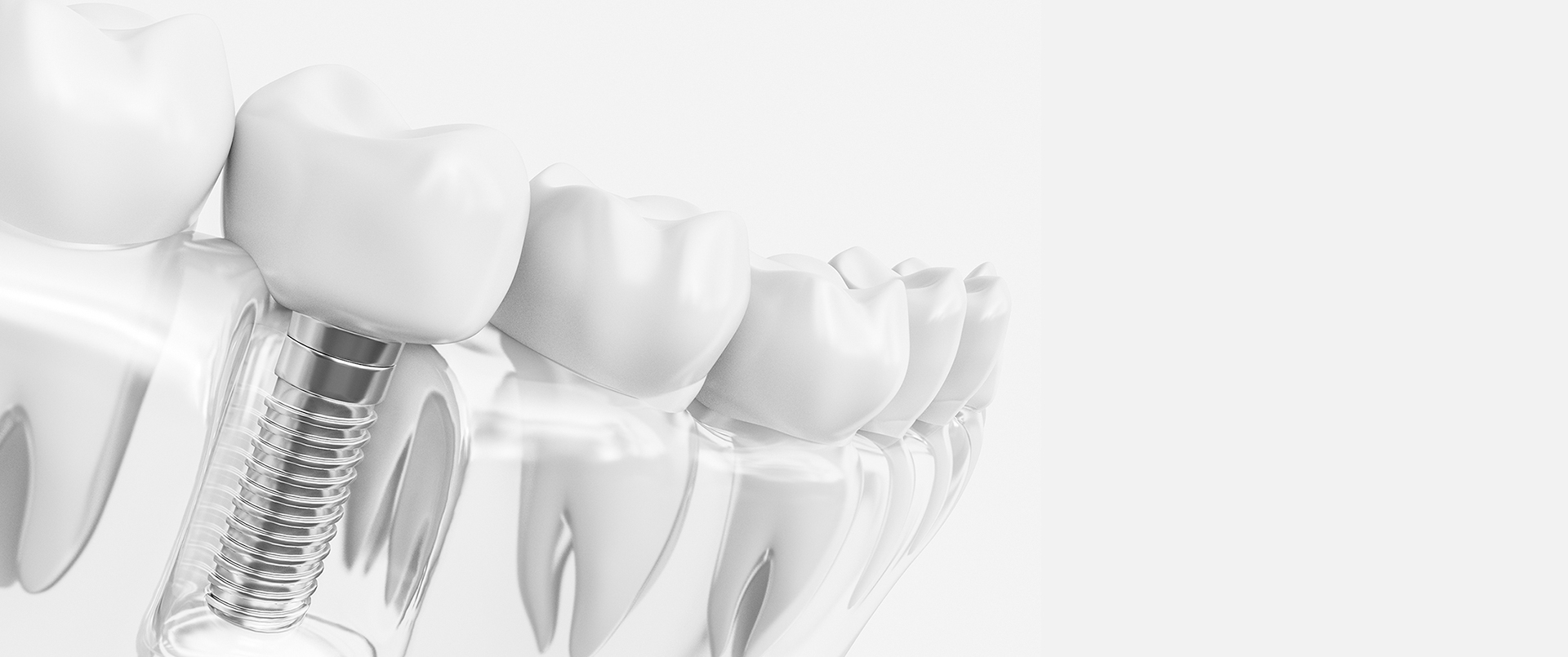 Clinica Medicina Dentaria - Antonio Cardoso - Servicos