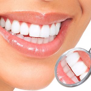 Clinica Medicina Dentaria - Antonio Cardoso - Servicos Branqueamento