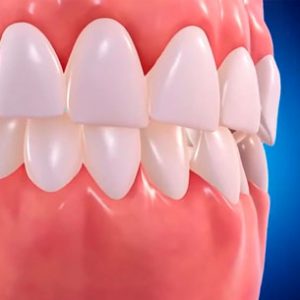 Clinica Medicina Dentaria - Antonio Cardoso - Servicos Oclusão