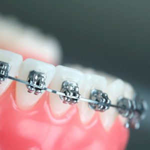 Clinica Medicina Dentaria - Antonio Cardoso - Servicos Ortodontia