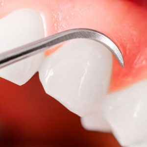 Clinica Medicina Dentaria - Antonio Cardoso - Servicos Periontologia